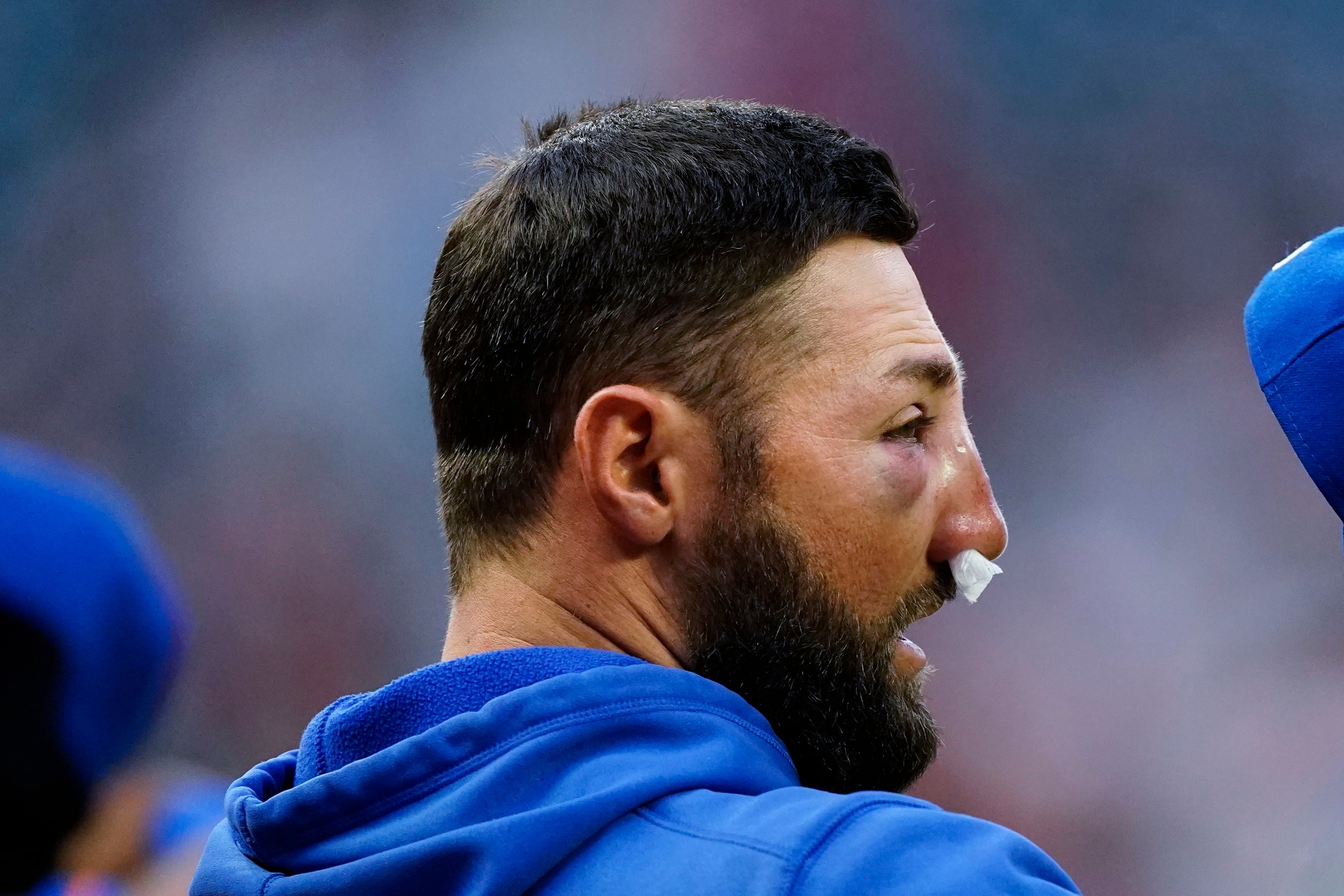 Photo Of Kevin Pillar Shows Nasty Injuries After Getting Hit In